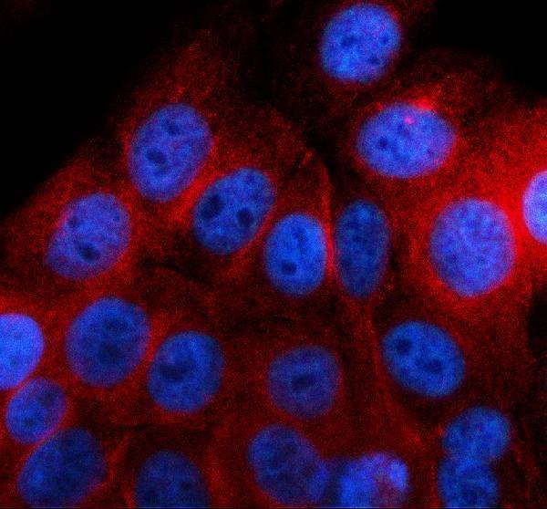a02927 3 rsad2 primary antibodies if testing 1