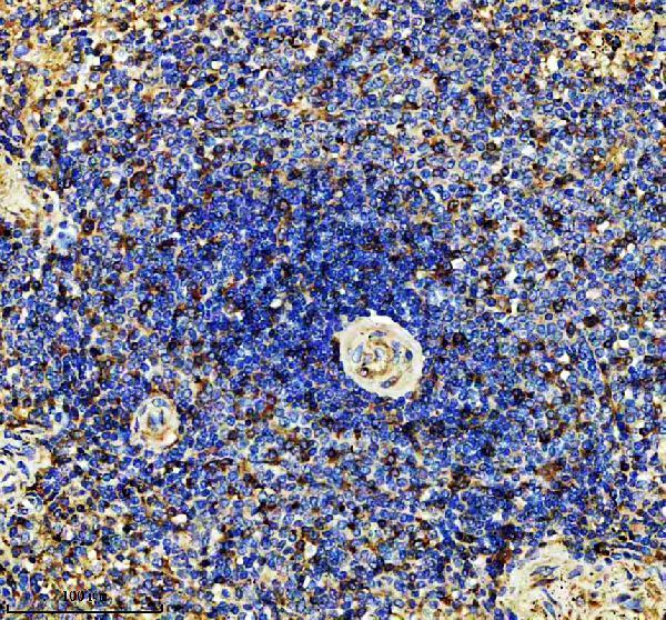IHC analysis of RSAD2 using anti-RSAD2 antibody (A02927-3)