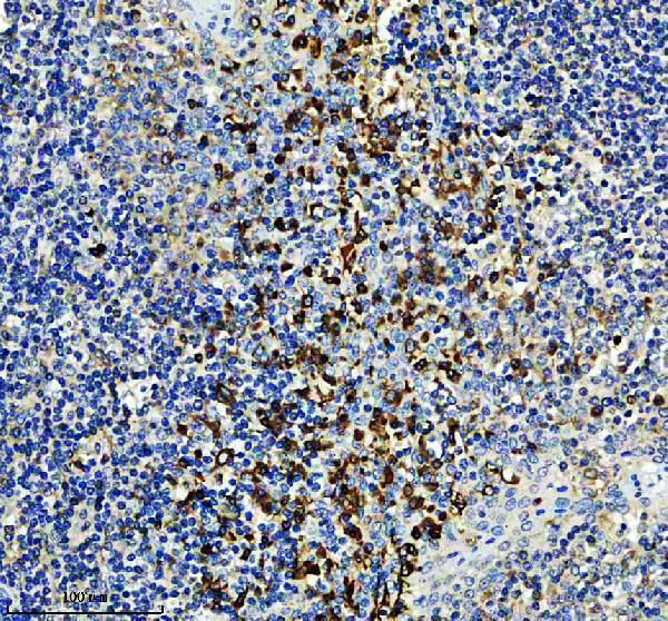IHC analysis of RSAD2 using anti-RSAD2 antibody (A02927-3)