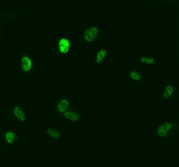 a02928 1 ppm1a primary antibodies if testing 1