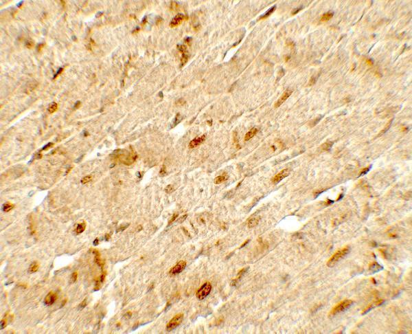 Immunohistochemistry of ANGPTL3 in rat heart tissue with ANGPTL3 antibody at 5 μg/mL