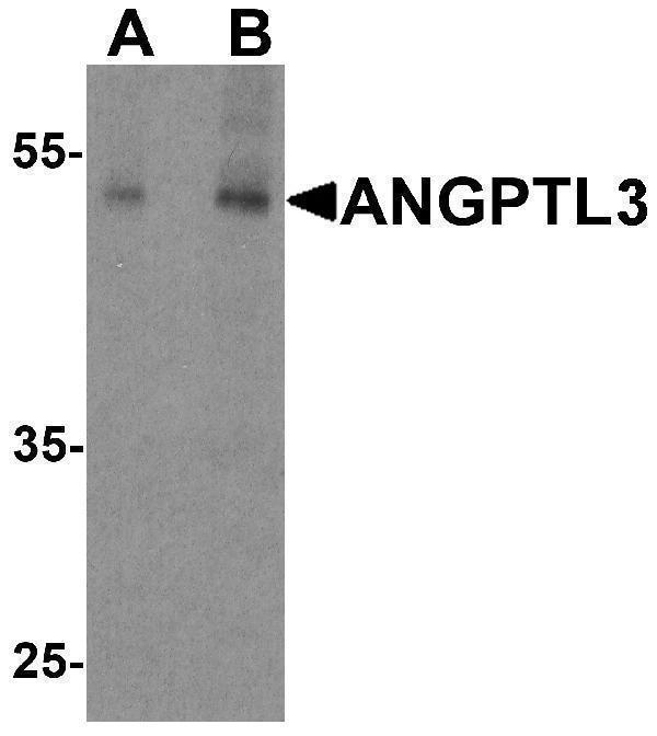 Western blot analysis of ANGPTL3 in human heart tissue lysate with ANGPTL3 antibody at (A) 1 and (B) 2 μg/ml