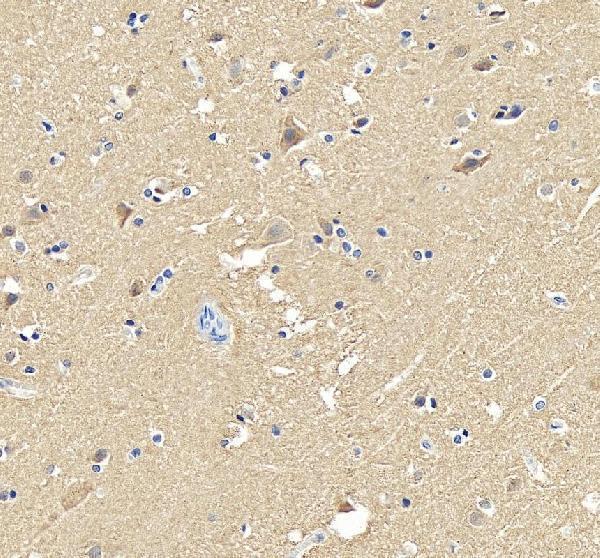 IHC analysis of NSE/ENO2 using anti-NSE/ENO2 antibody (A02930)