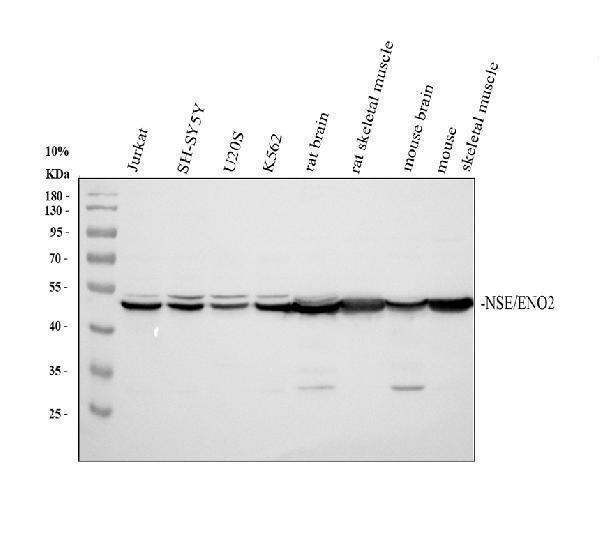Western blot analysis of NSE/ENO2 using anti-NSE/ENO2 antibody (A02930)