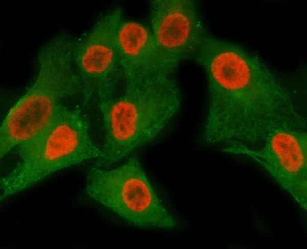 a02931 2 matr3 primary antibodies if testing 10