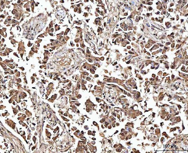 a02931 2 matr3 primary antibodies ihc testing 2