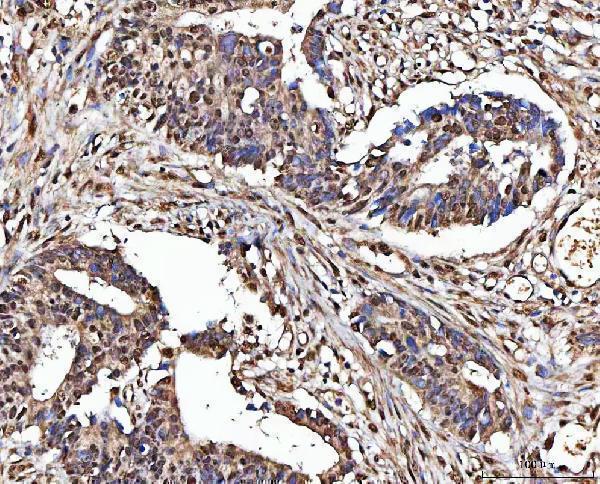 a02931 2 matr3 primary antibodies ihc testing 3