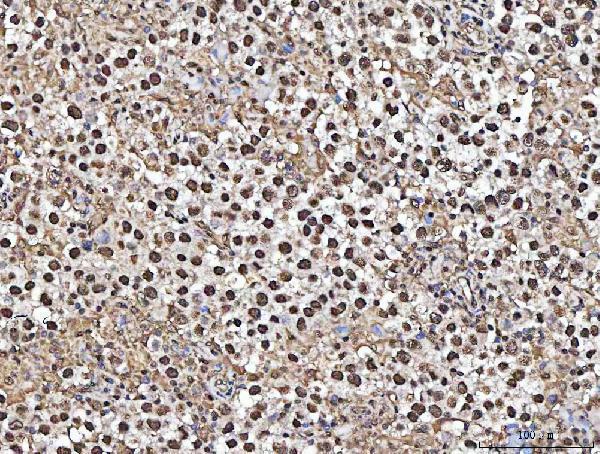 a02931 2 matr3 primary antibodies ihc testing 5