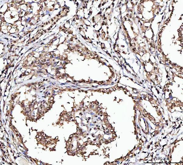 a02931 2 matr3 primary antibodies ihc testing 6