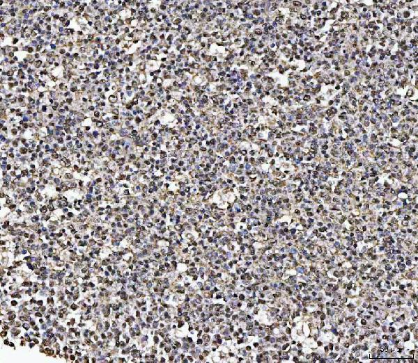 a02931 2 matr3 primary antibodies ihc testing 7