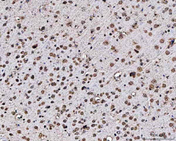 a02931 2 matr3 primary antibodies ihc testing 8