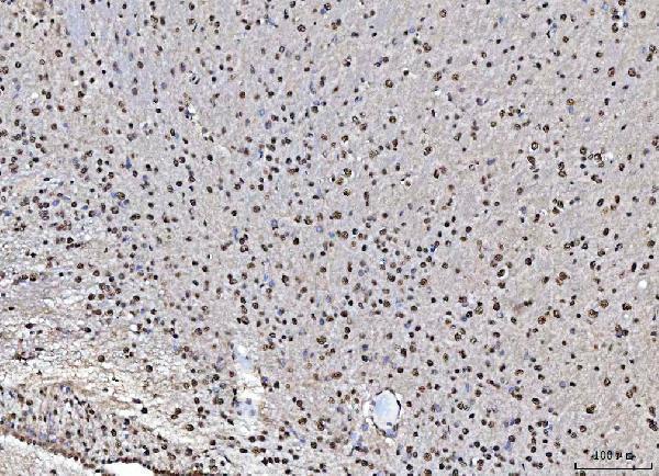 a02931 2 matr3 primary antibodies ihc testing 9