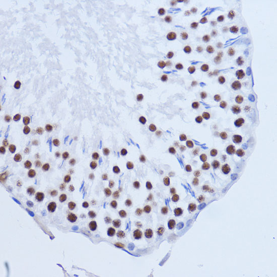 a02931 matr3 primary antiboties ihc testing 2