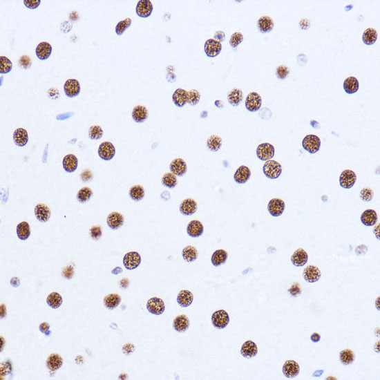 a02931 matr3 primary antiboties ihc testing 4