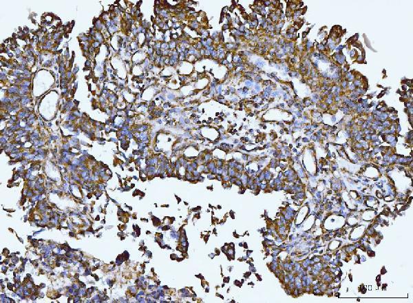 a02932 2 ilk primary antibodies ihc testing 2