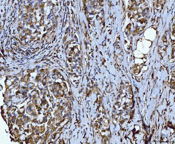 a02932 2 ilk primary antibodies ihc testing 4