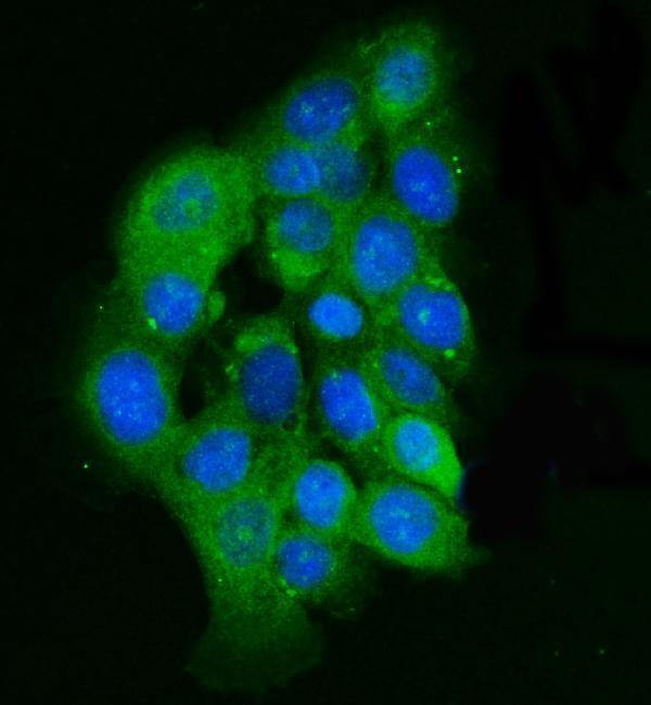 a02932 3 ilk primary antibodies if testing 9