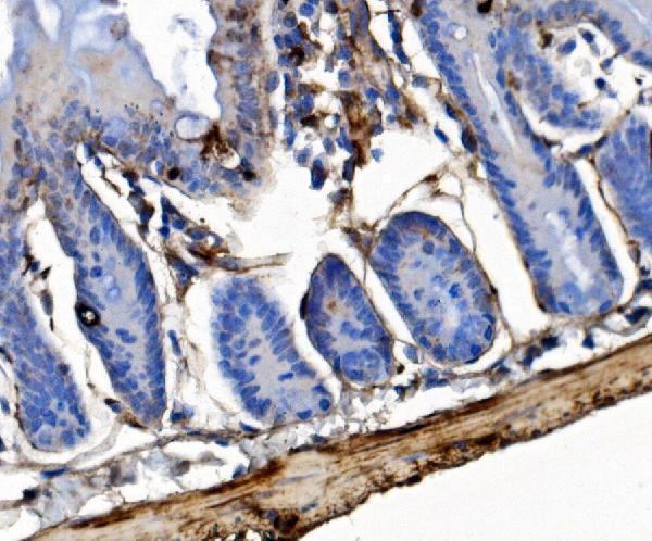  IHC analysis of Integrin Linked ILK using anti-Integrin Linked ILK antibody (A02932-3)