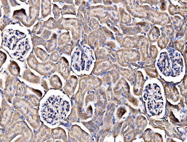  IHC analysis of Integrin Linked ILK using anti-Integrin Linked ILK antibody (A02932-3)