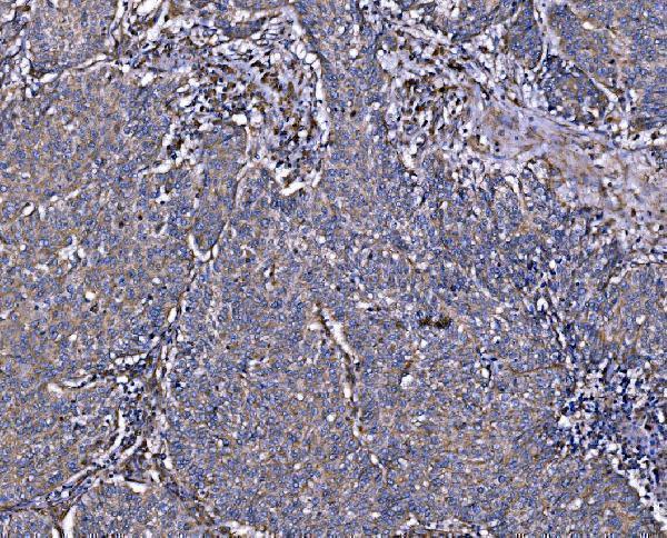 a02932 3 ilk primary antibodies ihc testing 4