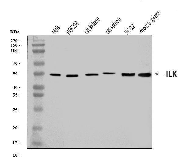  Western blot analysis of Integrin Linked ILK using anti-Integrin Linked ILK antibody (A02932-3)
