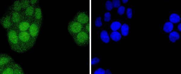 a02935 1 irf2 primary antiboties icc testing 2