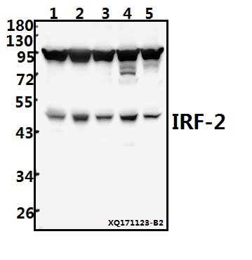 Western blot (WB) analysis of IRF-2 (K129) pAb at 1:500 dilution
Lane1:A549 whole cell lysate(40ug)
Lane2:SGC7901 whole cell lysate(40ug)
Lane3:HepG2 whole cell lysate(40ug)
Lane4:PC12 whole cell lysate(40ug)
Lane5:AML-12 whole cell lysate(40ug)