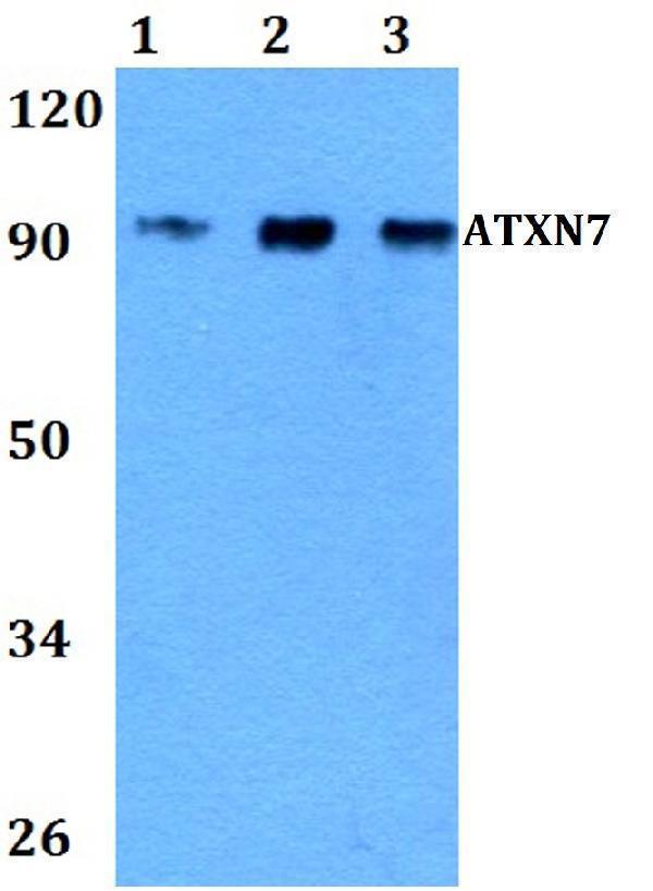 Western blot (WB) analysis of ATXN7 polyclonal antibody at 1:500 dilution
Lane1:A549 whole cell lysate
Lane2:NIH-3T3 whole cell lysate 
Lane3:PC12 whole cell lysate 
