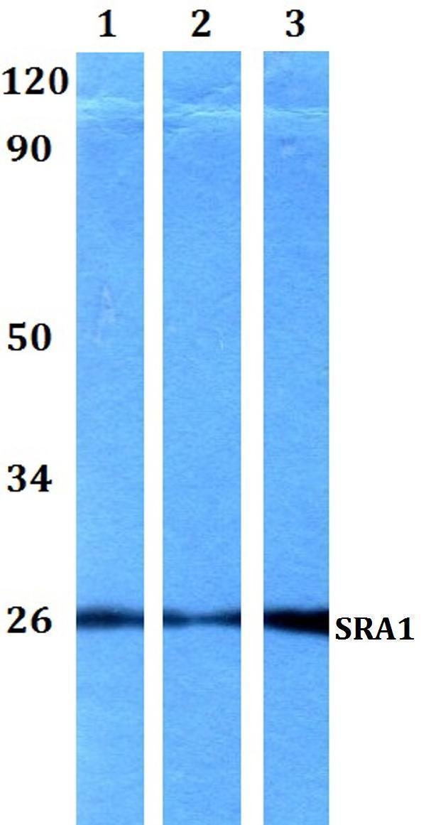 Western blot (WB) analysis of SRA1 polyclonal antibody at 1:500 dilution
Lane1:HEK293T whole cell lysate
Lane2:sp2/0 whole cell lysate 
Lane3:PC12 whole cell lysate 