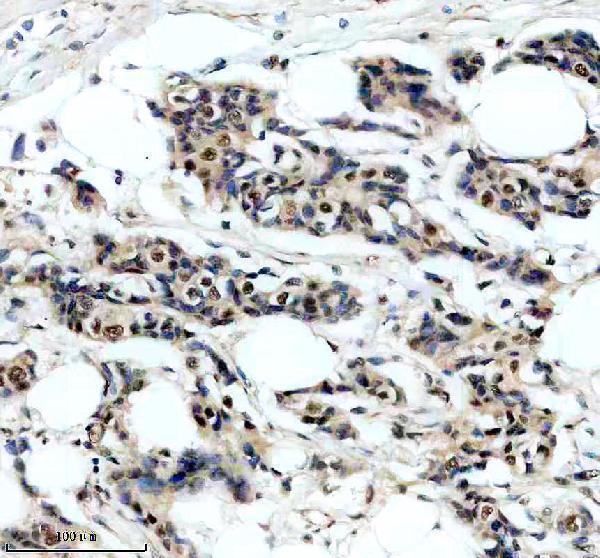 IHC analysis of SRA1 using anti-SRA1 antibody (A02942-2)