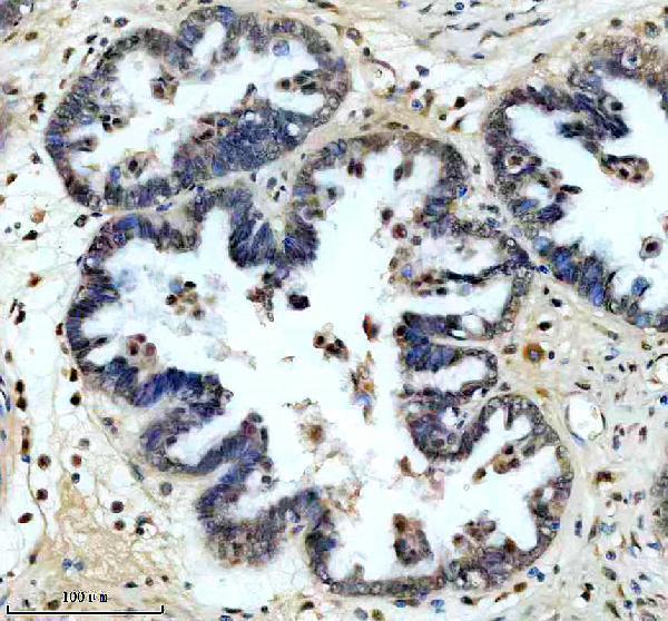 a02942 2 2 sra1 primary antibodies ihc testing 2