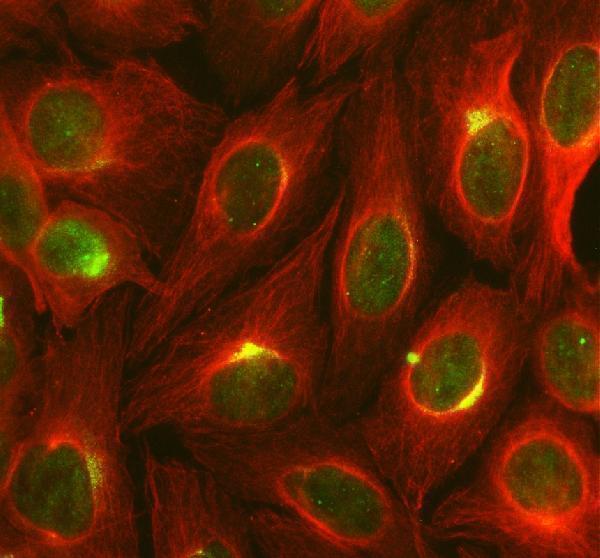 IF analysis of SRA1 using anti-SRA1 antibody (A02942-2) and anti-Beta Tubulin antibody (M01857-3)