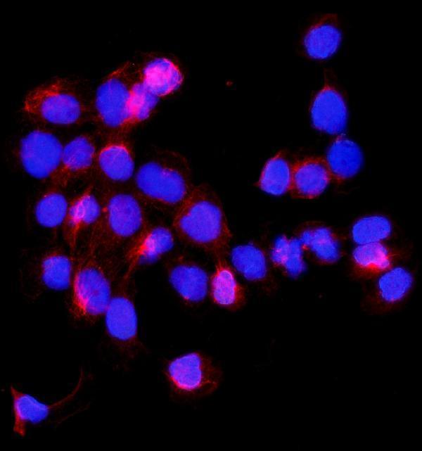 a02944 1 shmt1 primary antibodies if testing 2