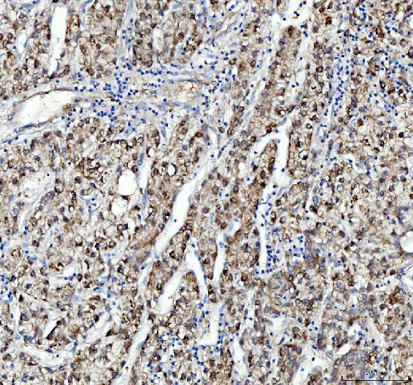 IHC analysis of SHMT1 using anti-SHMT1 antibody (A02944-1)