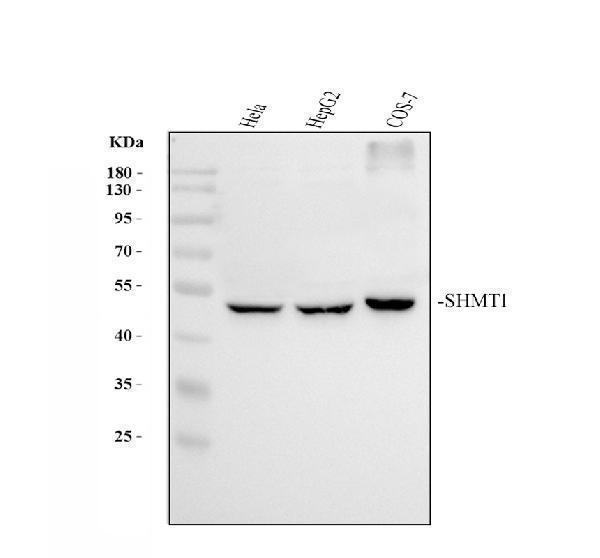 Western blot analysis of SHMT1 using anti-SHMT1 antibody (A02944-1)
