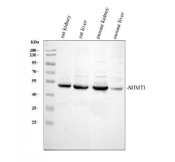 Western blot analysis of SHMT1 using anti-SHMT1 antibody (A02944-1)