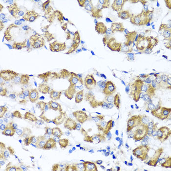 a02944 shmt1 primary antiboties ihc testing 2