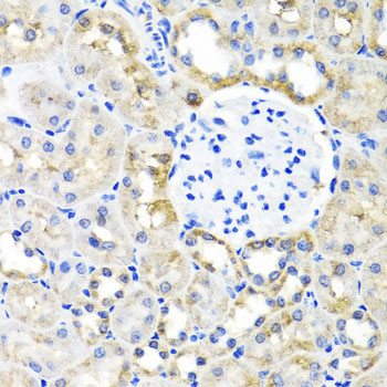 a02944 shmt1 primary antiboties ihc testing 3