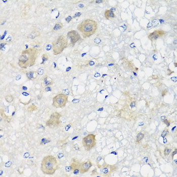 a02944 shmt1 primary antiboties ihc testing 4
