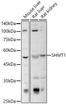 a02944 shmt1 primary antiboties wb testing 1
