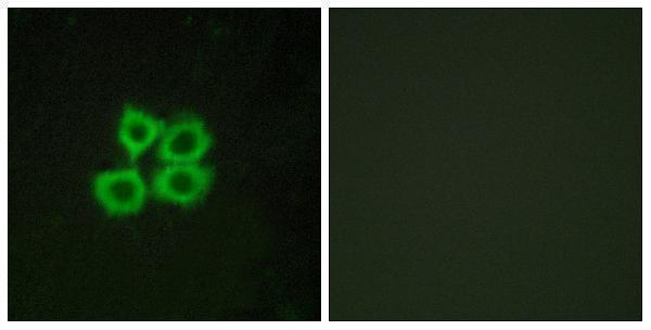 a02945 1 crhr2 primary antibodies if testing 1