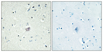 Immunohistochemical analysis of paraffin-embedded Human brain