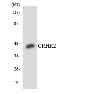 Western blot analysis of the lysates from HepG2 cells using CRHR2 antibody