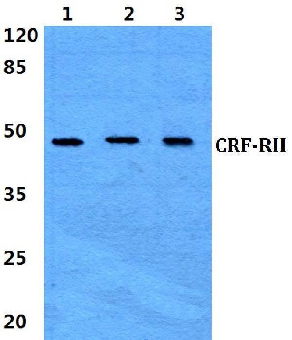 a02945 crhr2 primary antiboties wb testing 1
