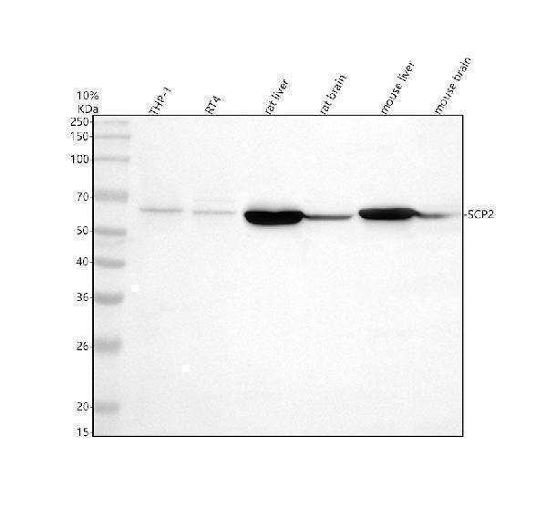 Western blot analysis of SCP2 using anti-SCP2 antibody (A02947-2)