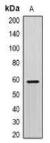 Western blot analysis of SCP2 expression in HepG2 (A) whole cell lysates
