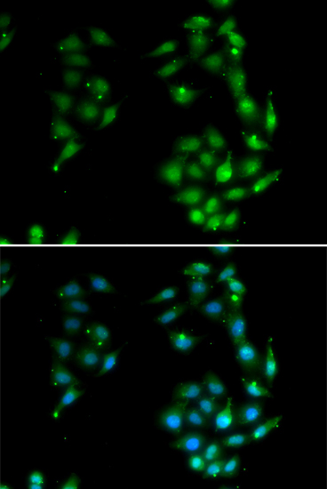 Immunohistochemistry of paraffin-embedded mouse embryos using SOX5 Rabbit pAb  at dilution of 1:50 