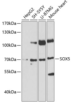 Western blot analysis of extracts of Mouse brain, using SOX5 antibody  at  1:2370 dilution