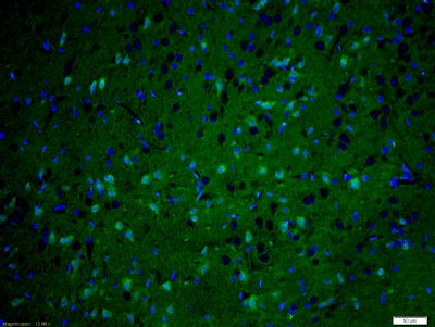 Tissue/cell: rat brain tissue;4% Paraformaldehyde-fixed and paraffin-embedded;
Antigen retrieval: citrate buffer ( 0