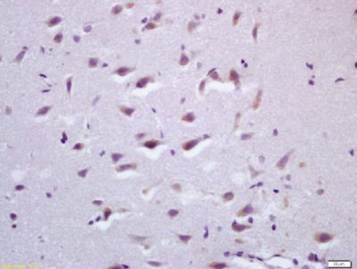 Tissue/cell: rat brain tissue; 4% Paraformaldehyde-fixed and paraffin-embedded;
Antigen retrieval: citrate buffer ( 0